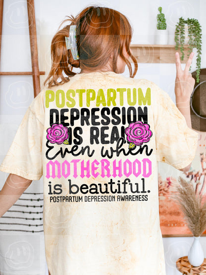 Postpartum, DTF Transfer
